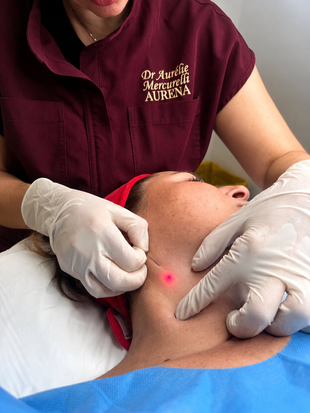 Séance d'Endolift réalisée à la clinique AURENA